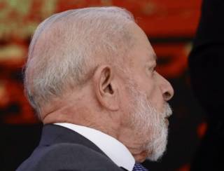 Presidente Lula passa por procedimento para evitar novo sangramento na cabeça 